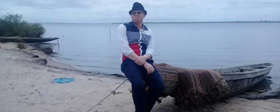 Evrad Celestin Danfa: « Se servir des réseaux sociaux pour promouvoir le leadership des albinos »