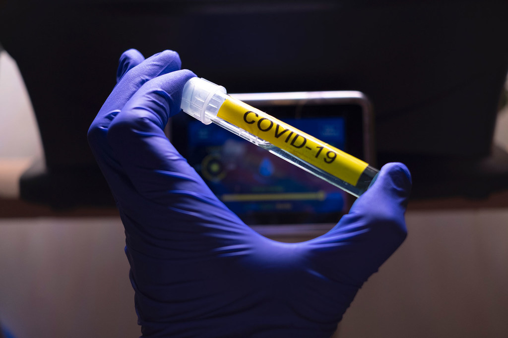 Vaccin contre la COvid19 : Covax obtient un appui 556 milliards de fcfa