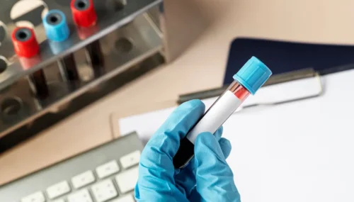 Un nouveau test sanguin accélère le diagnostic du cancer chez l&rsquo;enfant